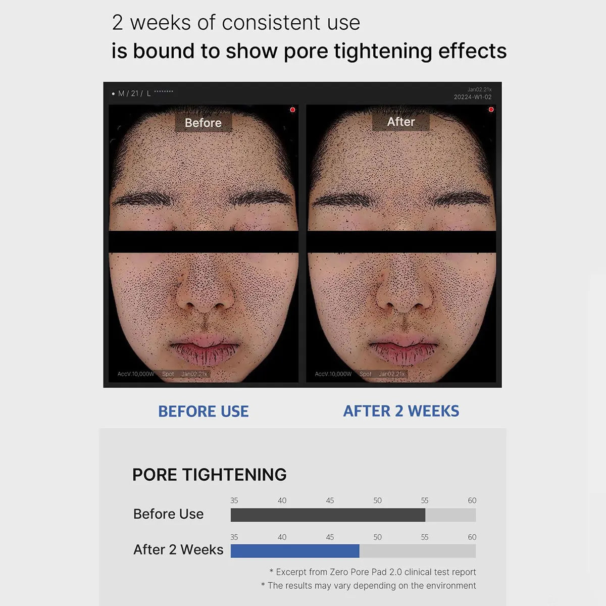 Medicube Zero Pore Pad 2.0 – Dual-Texture Toner Pads