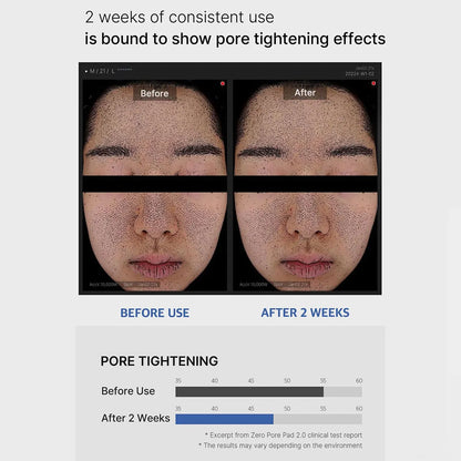 Medicube Zero Pore Pad 2.0 – Dual-Texture Toner Pads